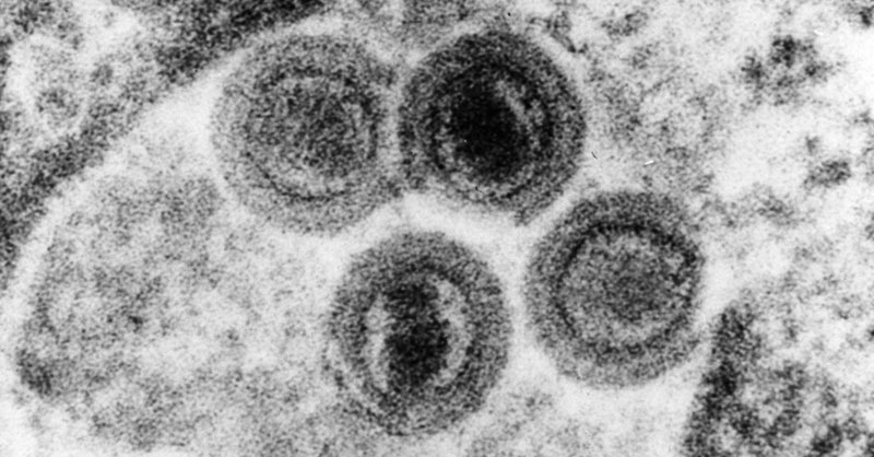 ヘルペスウィルス